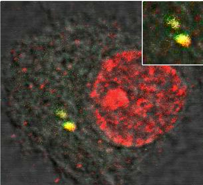 Her ses hvordan en celle med forsvarsproteinet (rød farve) fanger hiv uden for cellens kerne (gul farve). Dette bevirker, at cellens forsvarssystem aktiveres og efterfølgende blokerer hiv-infektionen.
